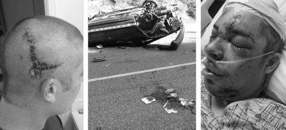 Xander Scott Car Accident 1